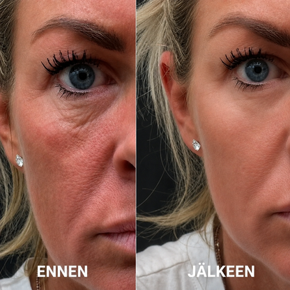 Peptidi-Kollageeni Silmälaput (60 kpl)