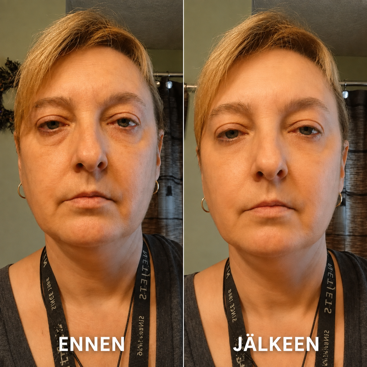 Peptidi-Kollageeni Silmälaput (60 kpl)